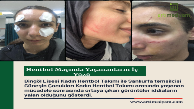 Hentbol Maçında Yaşananların İç Yüzü